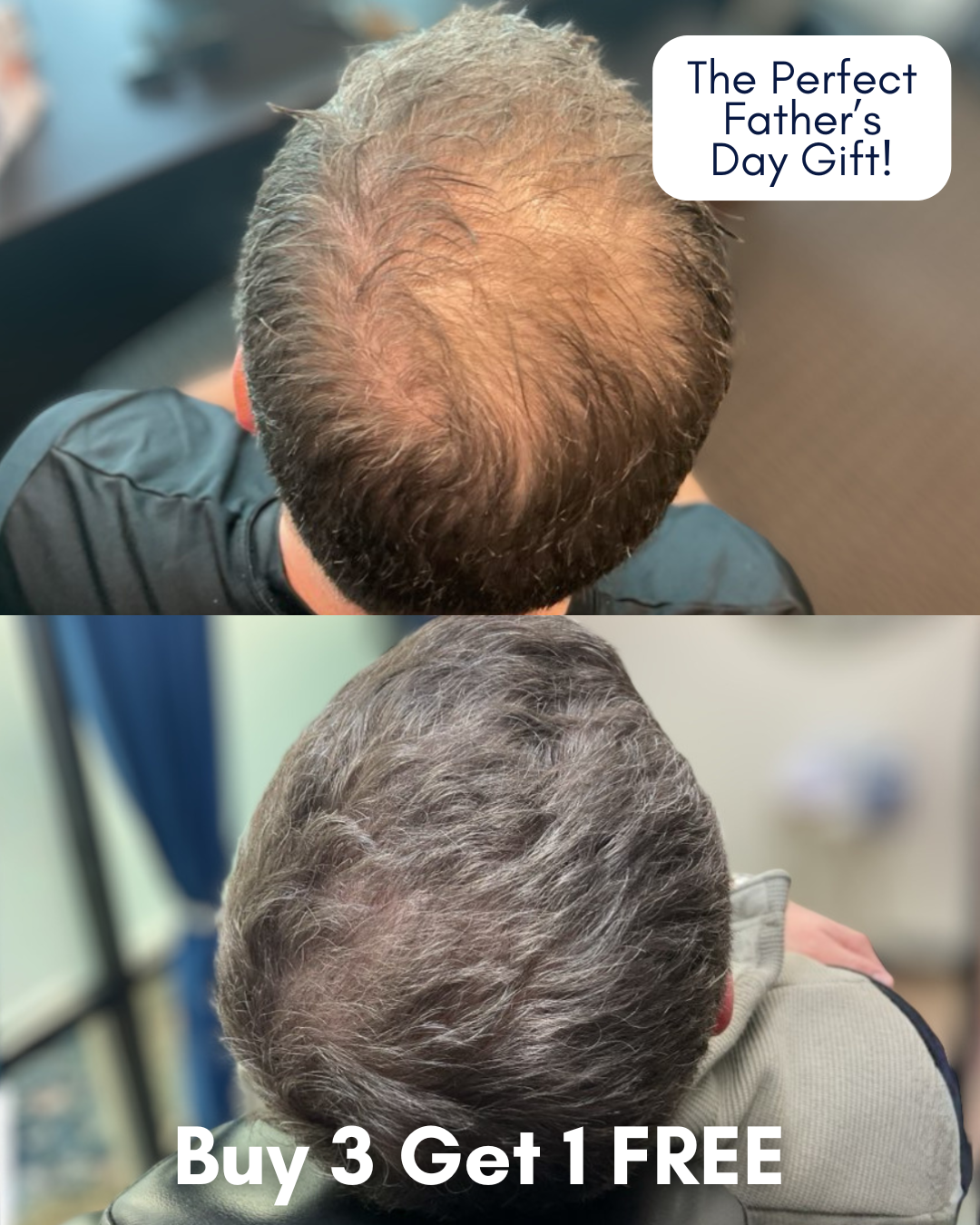 Before-and-after photos of a man’s thinning crown vs. fuller hair after treatment, with promo bubbles: 'The Perfect Father's Day Gift!' and 'Buy 3 Get 1 FREE'