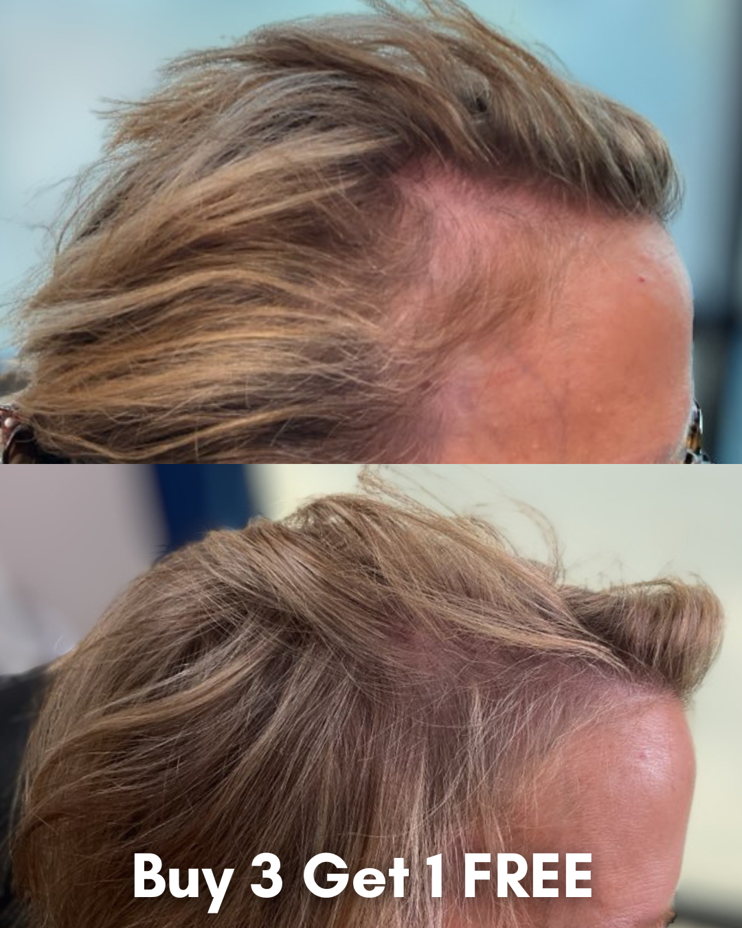 Side-by-side before-and-after photos showing improved hair fullness; advertisement text 'Buy 3 Get 1 FREE' at bottom center.